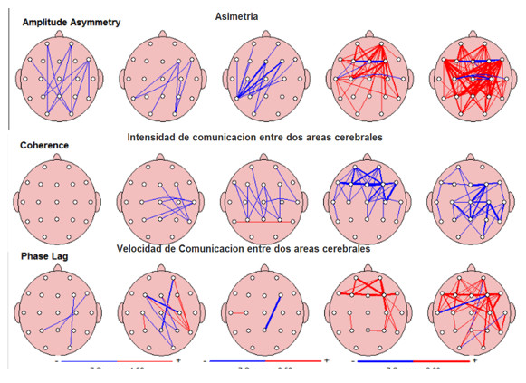 Escáner Cerebral qEEG en Girona