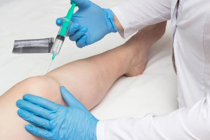 Terapia de ozono en España
